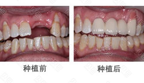 金华看牙哪家好?2025年权威口腔医院排名发布,这10家机构技术领先、服务优质(图4)