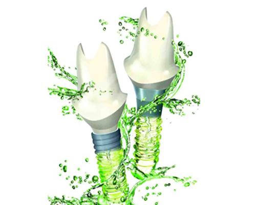 乐山安普口腔·牙齿矫正·种植修复怎么样？医生技术精湛-设备先进-环境优雅-收费透明-患者好评！(图4)