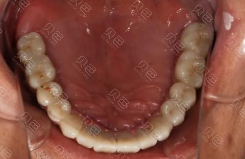 上海浦东新区哪家口腔医院好?推荐5家正规靠谱的牙齿矫正-种植牙机构(图4)