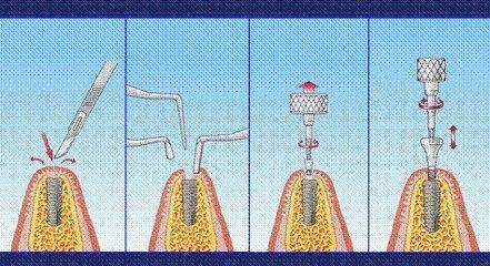 重庆荣昌区口腔医院哪家好?这5家荣昌口碑牙科机构技术过硬,收费透明!(图2)