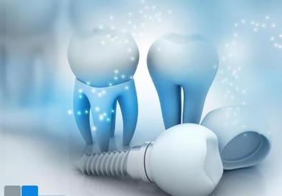 种植牙与烤瓷牙有什么区别?从优缺点全面解析种植牙与烤瓷牙的不同选择!(图2)