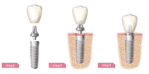 上海牙齿矫正哪家医院好？这5家口腔机构技术精湛、口碑优良！(图2)