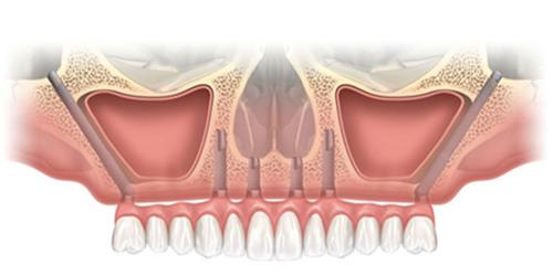 黄石牙科哪家好又实惠？这5家本地人常去的优质口腔医院推荐！