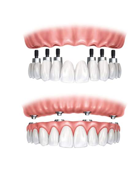 苏州牙博士·数字化种植中心（城西店）怎么样？从医生团队到特色项目全面解析！(图3)