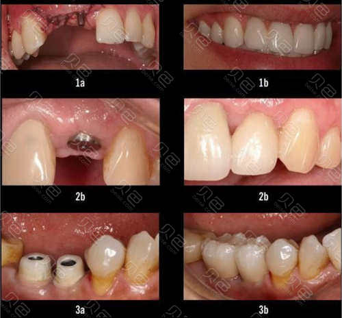 北京优贝口腔医院怎么样？专业正规口腔机构技术实力与服务质量全面解析(图3)