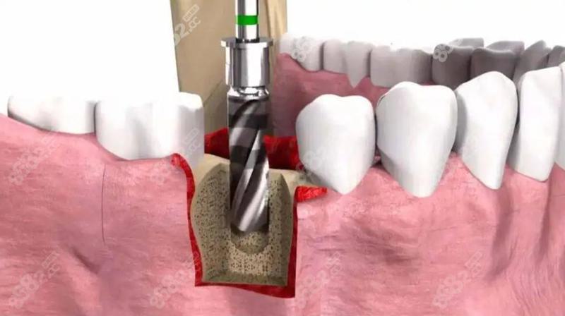 菏泽牙科技术好的三个医院是哪家？菏泽牙科技术好的三个医院是菏泽美尔口腔、菏泽中华口腔、菏泽曹州口腔医院(图3)