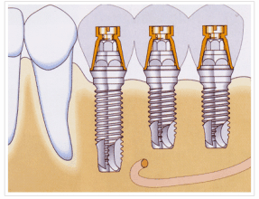 九江正规的牙科医院推荐五家，曝光九江哪家医院看牙齿好！(图2)