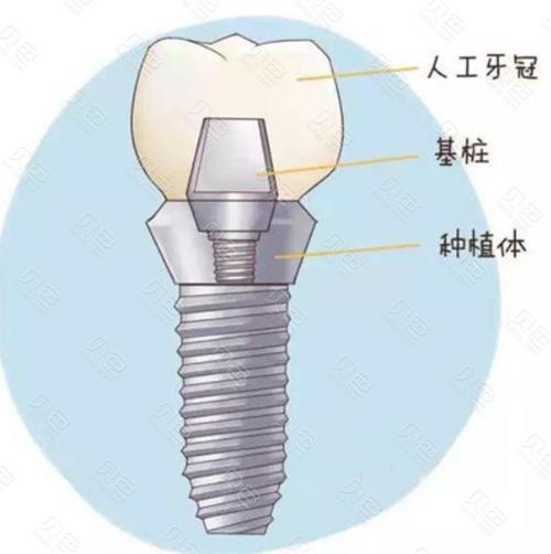 佛山牙科医院排名公布,都是广东佛山市好的牙科门诊诊所!(图2)