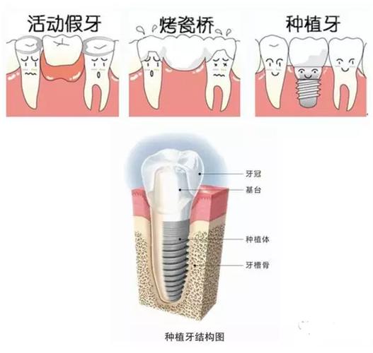 长沙德韩口腔•种植矫正中心怎么样？车站北路专业机构丨种植牙技术成熟丨医生团队经验丰富！(图3)