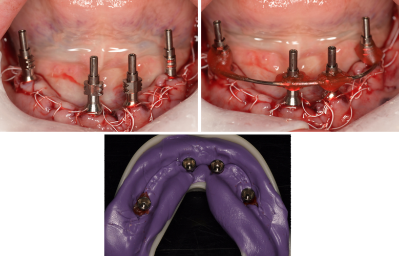 上海浦东新区哪家口腔医院好?推荐5家正规靠谱的牙齿矫正-种植牙机构(图3)