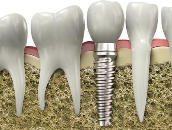 金华牙科医院哪家技术好又实惠?新杭-依云-蓝芽等机构优势对比