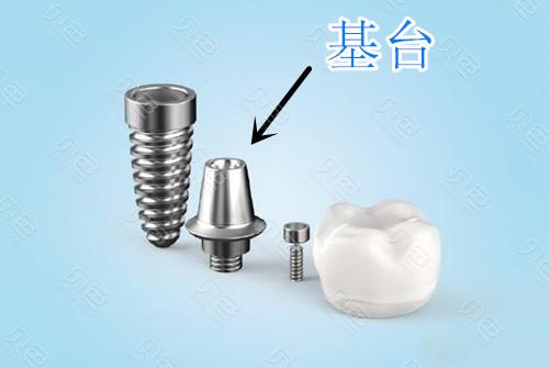 贵阳德艺口腔2025最新价格表公布！种植牙低至6800元+隐形矫正16800元起！