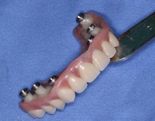 株洲天元区正规口腔排行前五！专业种植矫正技术强收费透明！(图2)