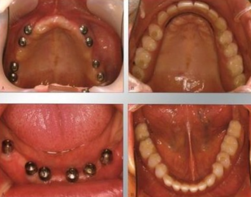 淄博张店区靠谱口腔机构盘点，诺尔漫-中心医院-四叶草-博瑞-盛德仁口腔实力上榜！(图4)