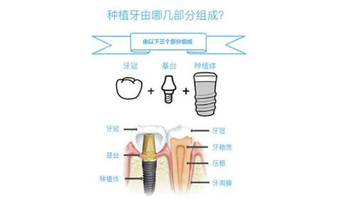 金华看牙哪家好?2025年权威口腔医院排名发布,这10家机构技术领先、服务优质(图3)