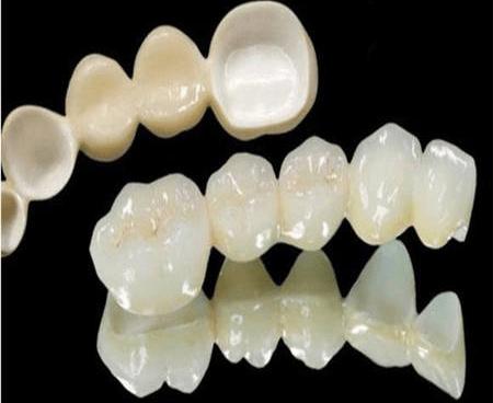 无锡种植牙多少钱一颗？2025年无锡热门口腔医院价格大公开！