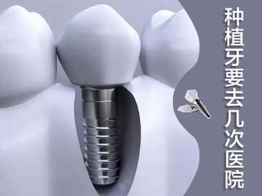 太原恒伦口腔(尚梵店)是正规医院吗?从资质认证到医疗团队全面解析其专业可靠性(图4)