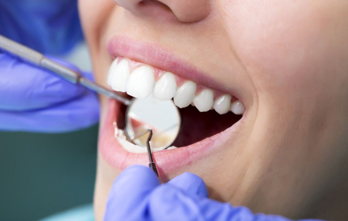 杭州西湖口腔医院怎么样?补牙-矫正-种植收费明细,价格透明!(图4)