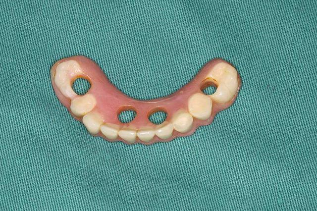 盘点昆明优质口腔医院排名，泰康拜博、德仕、长鹏口腔实力上榜！(图2)