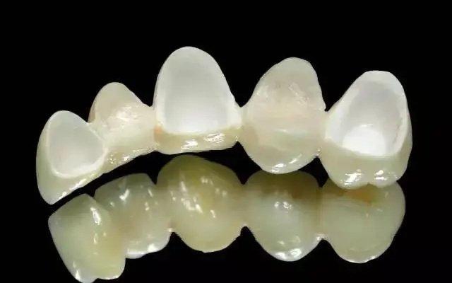 长沙哪家口腔医院比较好?长沙看牙攻略分享这几家正规牙科性价比高(图4)