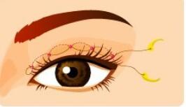 哪家医院的骨性龅牙矫正技术更出色?医院排名及推荐指南(图1)