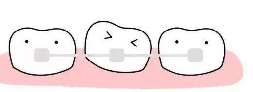 最新排名:北京口腔医院收费价格表!包含洗牙丨牙周治疗丨补牙丨种植牙丨牙齿矫正丨牙齿美白项目收费详情!