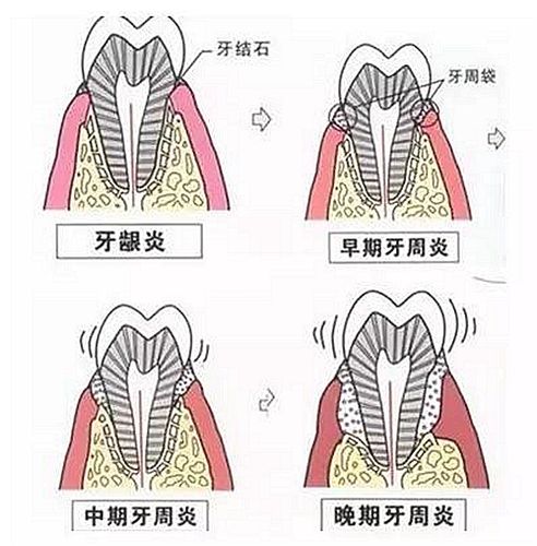 鞍山高英口腔牙齿矫正价格表2026，金属托槽和隐形矫正怎么选？
